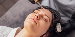 Pre-Wedding Skincare Mistakes to Avoid